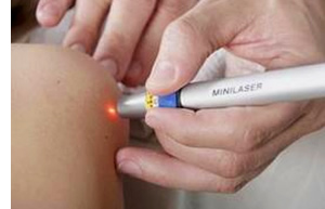 Tratamentul minim invaziv cu laser al pietrelor la rinichi | smartuniversetech.ro